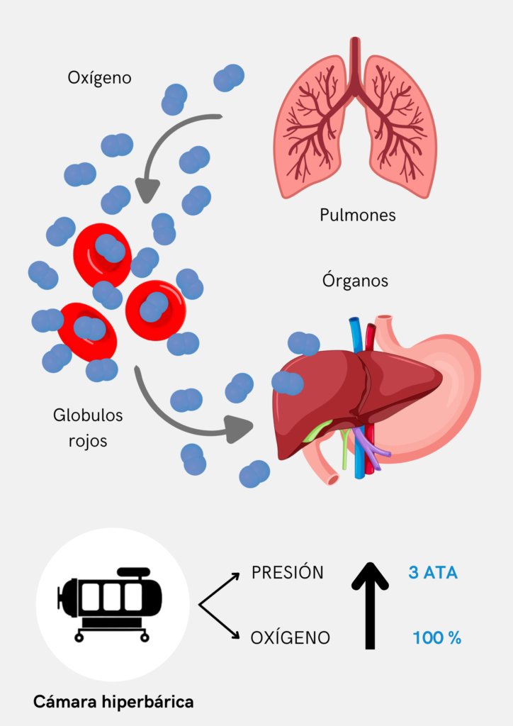 Infografia efectos cámara hiperbárica