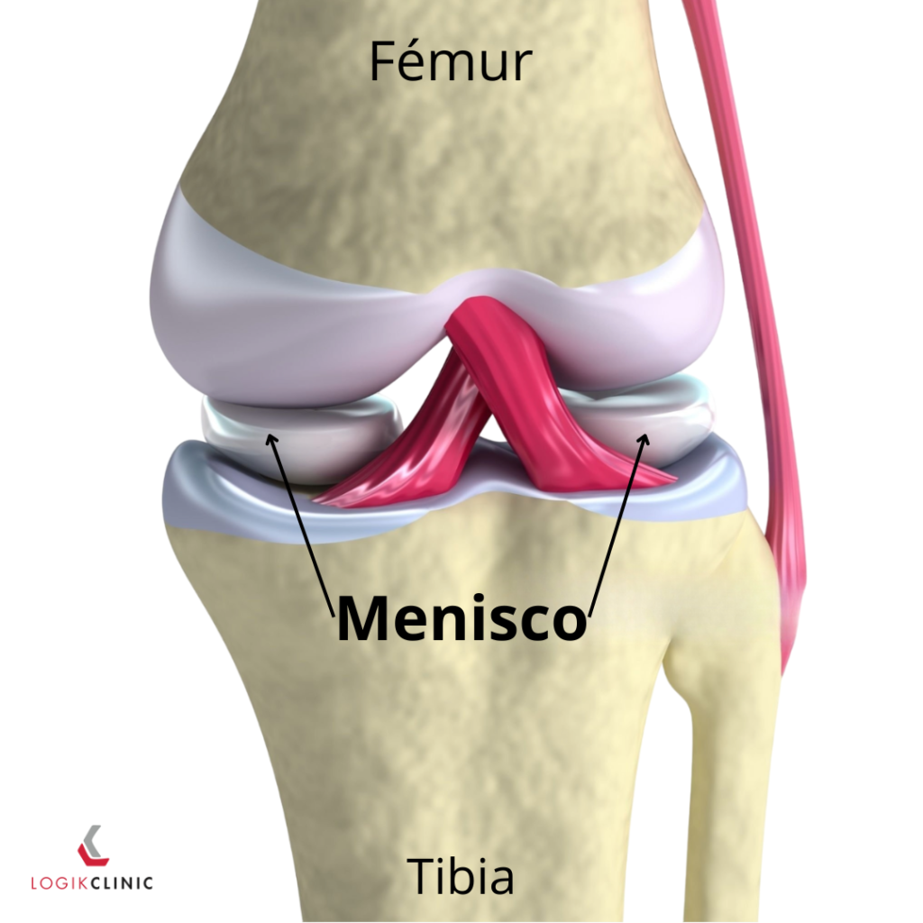 menisco roto